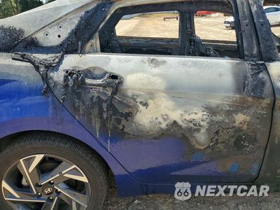 Zdjęcie 10 z 11 samochodu: 2025 HYUNDAI ELANTRA SEL VIN:KMHLS4DG4SU977042 - miniatura