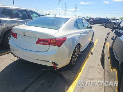 2018 Acura TLX w/Technology Pkg - zdjęcie 4 z 32 - miniatura
