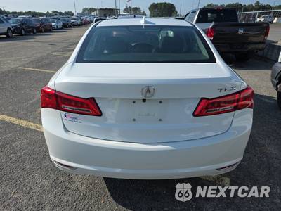 2018 Acura TLX - zdjęcie 5 z 24 - miniatura