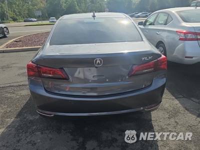 2017 Acura TLX w/Technology Package - zdjęcie 5 z 23 - miniatura