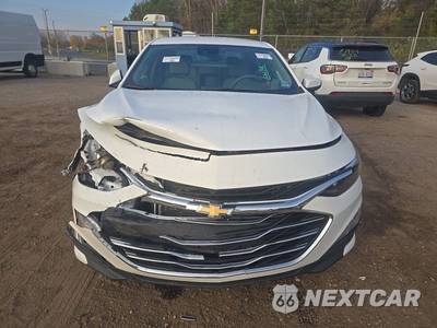 2025 Chevrolet Malibu LT 1LT - zdjęcie 2 z 17 - miniatura
